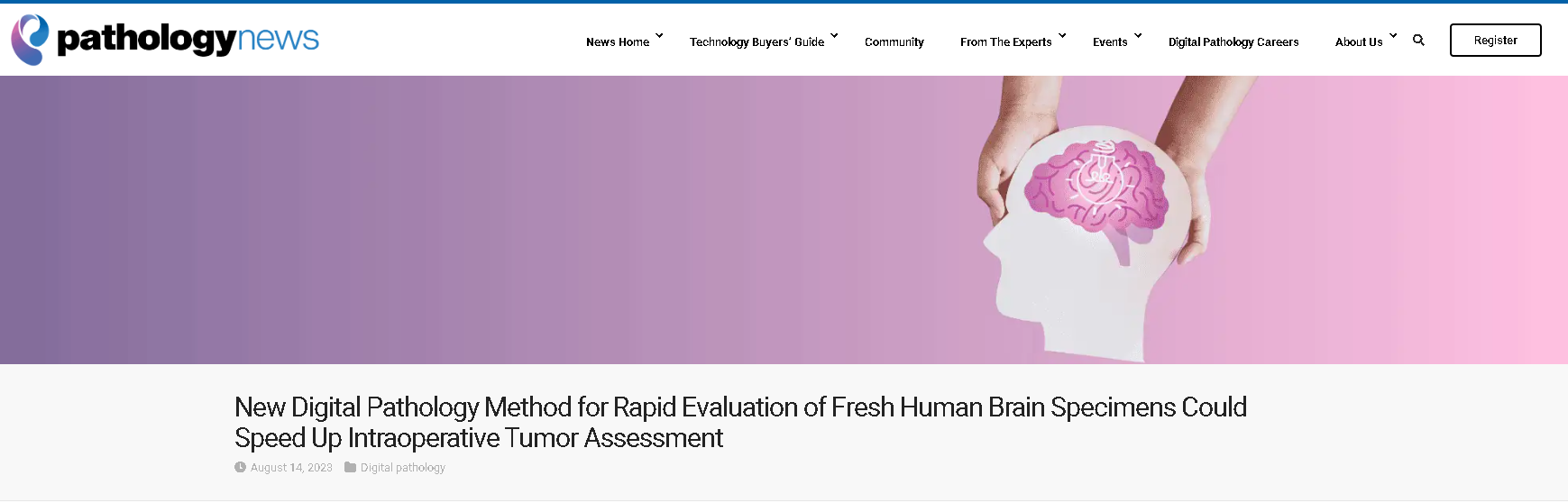 New Digital Pathology Method for Rapid Evaluation of Fresh Human Brain Specimens Could Speed Up Intraoperative Tumor Assessment